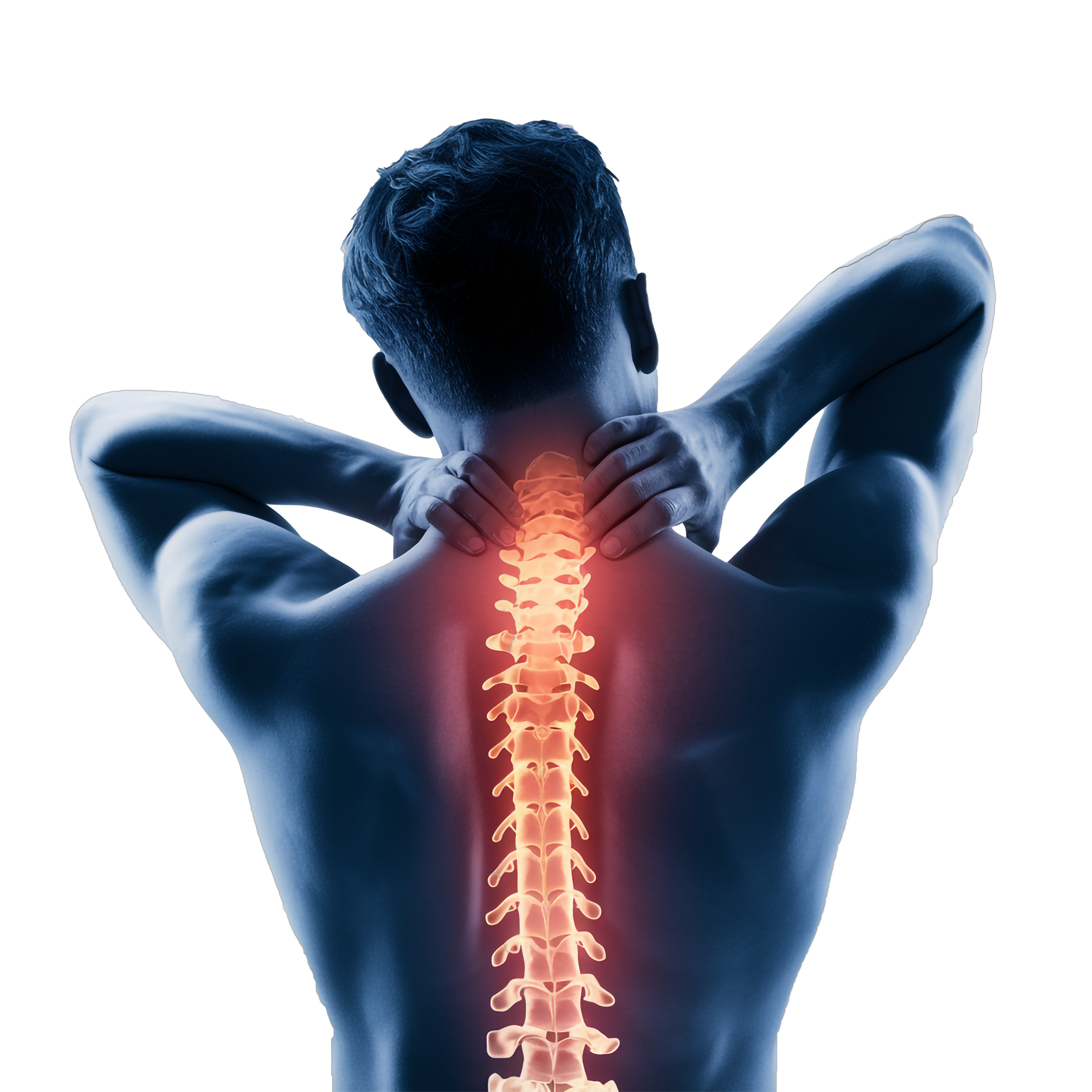 Colonna vertebrale - Problemi posturali